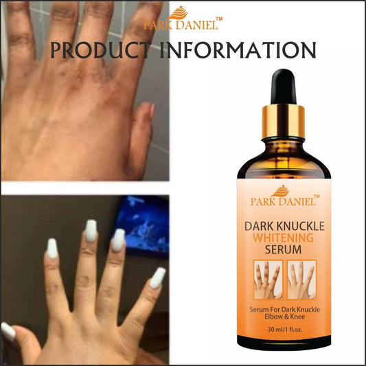 Park Daniel Skin Whitening Serum For Removing Dark Knuckles From Hand, Elbows and Knees Pack of 1 of 30 ML