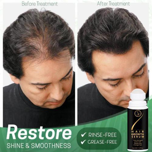 Hair Serum for Hair Growth Serum For Damaged & Dry Hair 45ml