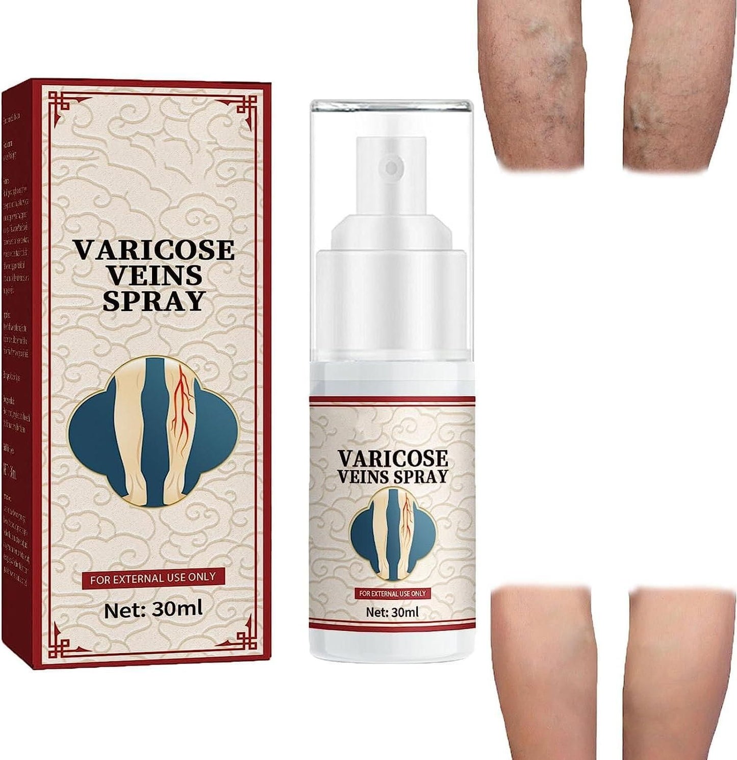 Vein Healing Varicose Veins Treatment Spray Pack of 2