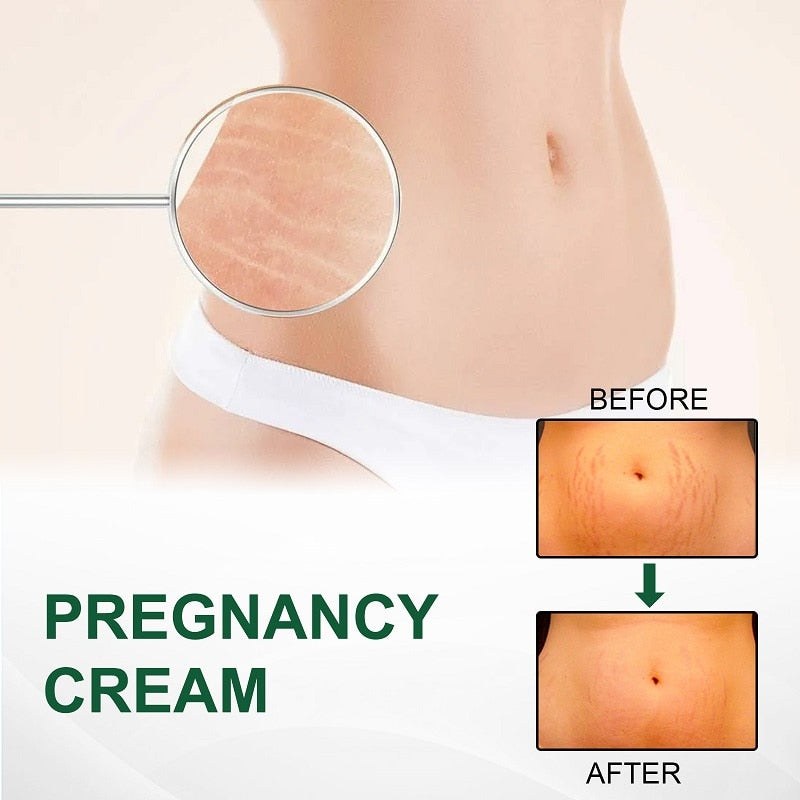 KURAIY Remove Pregnancy Scars Acne Cream Stretch Marks Treatment Maternity Repair Anti-Aging Anti-Winkles Firming Body Creams