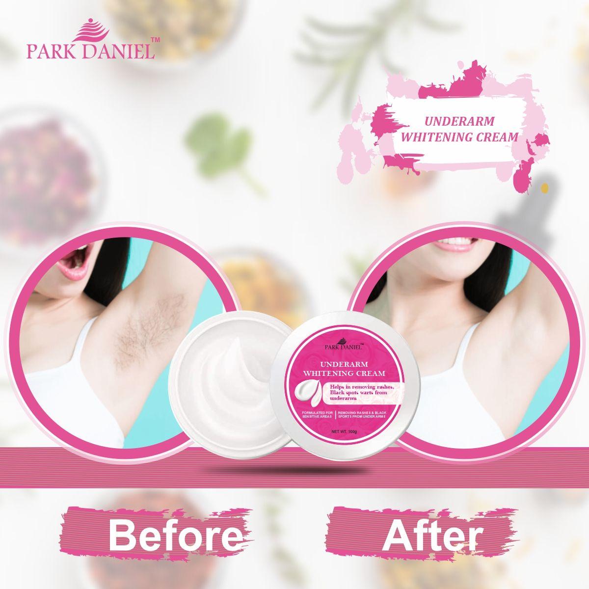 Park Daniel Underarms Darkness Lightening Cream Enriched with Kojic Acid, Nicinamide For Skin Pack of 2 of (100 grams)