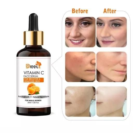 Driddle Professional Vitamin C Face Serum (Pack of 1)