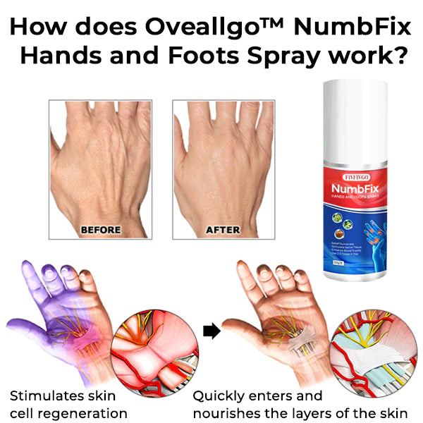 NumbFix Hands and Foots Spray