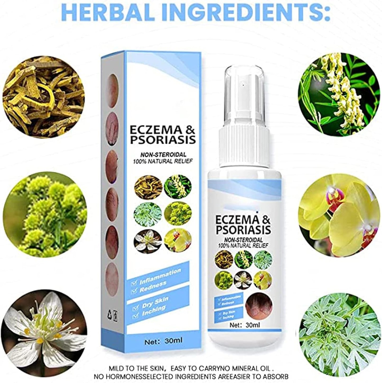 Herbal Psoriasis Relief Spray -Eczema Relief Spray, Stops Burning and Itching Pack of 1 of 30ML