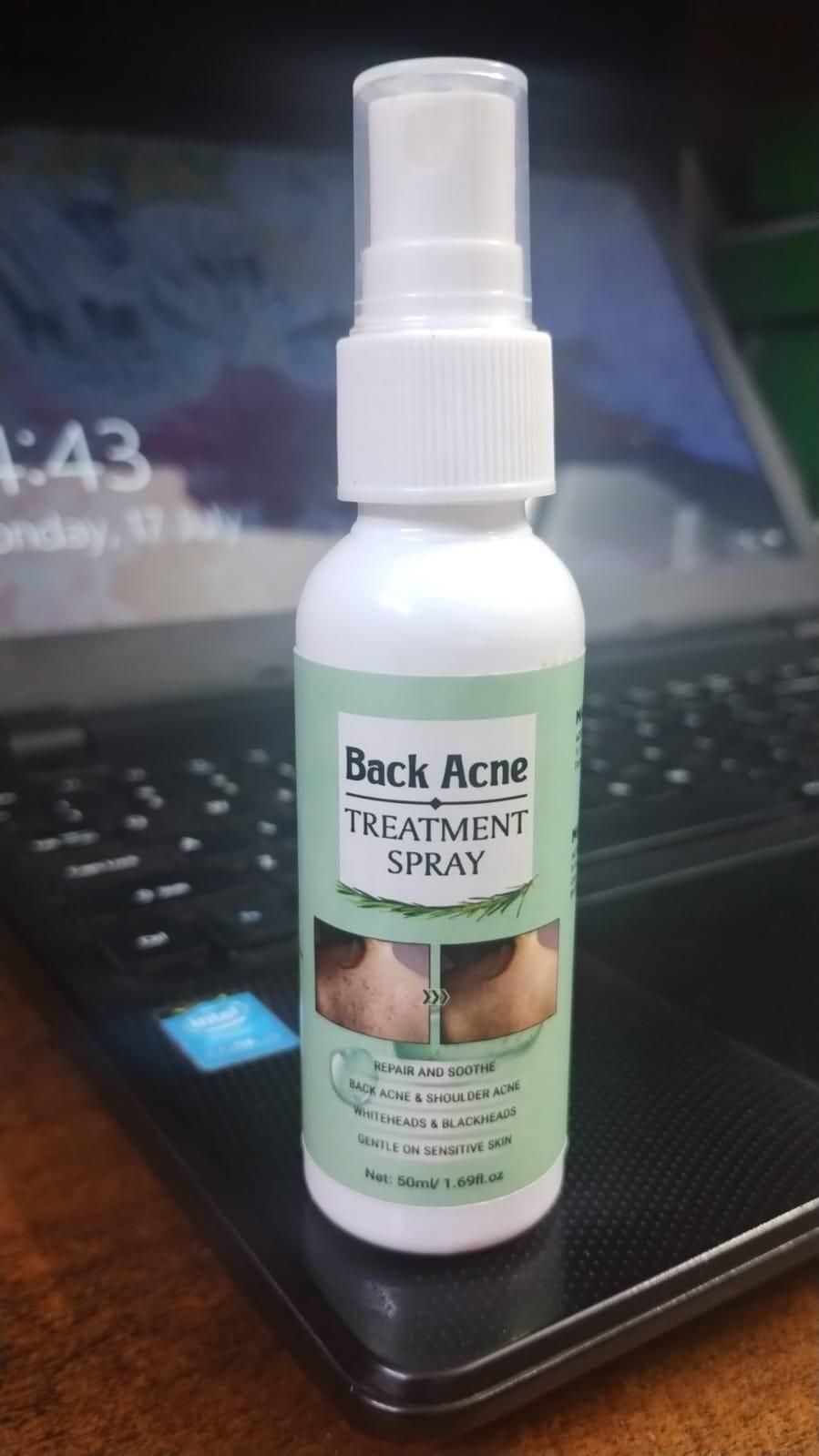Back Acne Treatment Spray (Pack of 2) - Deal IND.