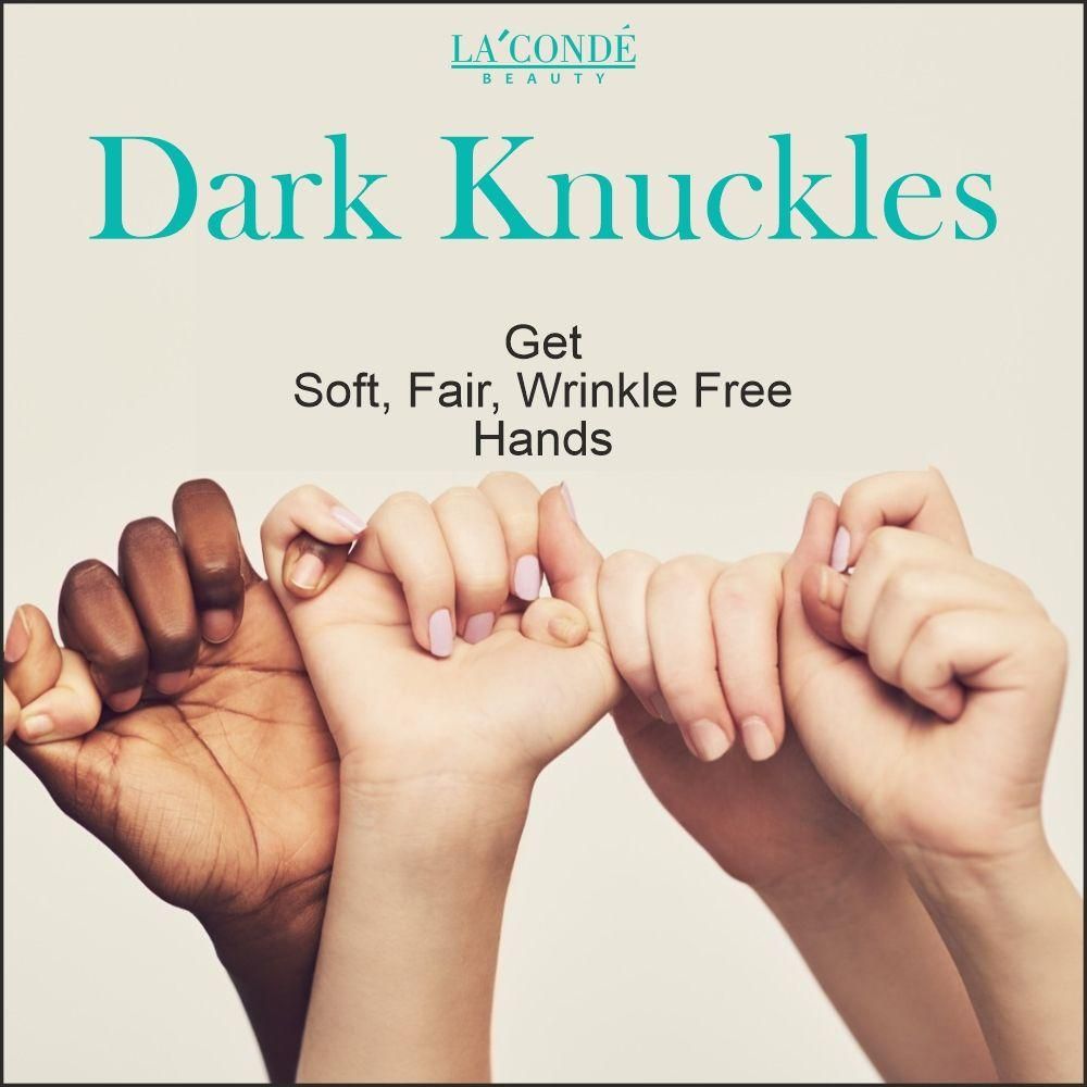 La'Conde Skin Whitening Serum For Removaing Dark Knuckles From Hand, Elbows and Knees Pack of 1 of 30 ML - Deal IND.