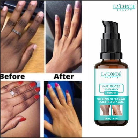 La'Conde Skin Whitening Serum For Removaing Dark Knuckles From Hand, Elbows and Knees Pack of 1 of 30 ML - Deal IND.