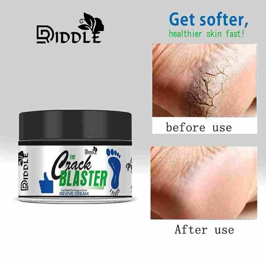 Driddle Foot Crack Remover Cream For Women & Men Pack of 2 - Deal IND.