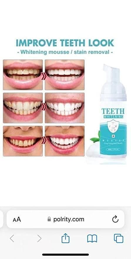 Teeth Whitening Foam - Deal IND.