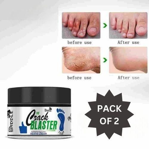 Driddle Foot Crack Remover Cream For Women & Men Pack of 2 - Deal IND.