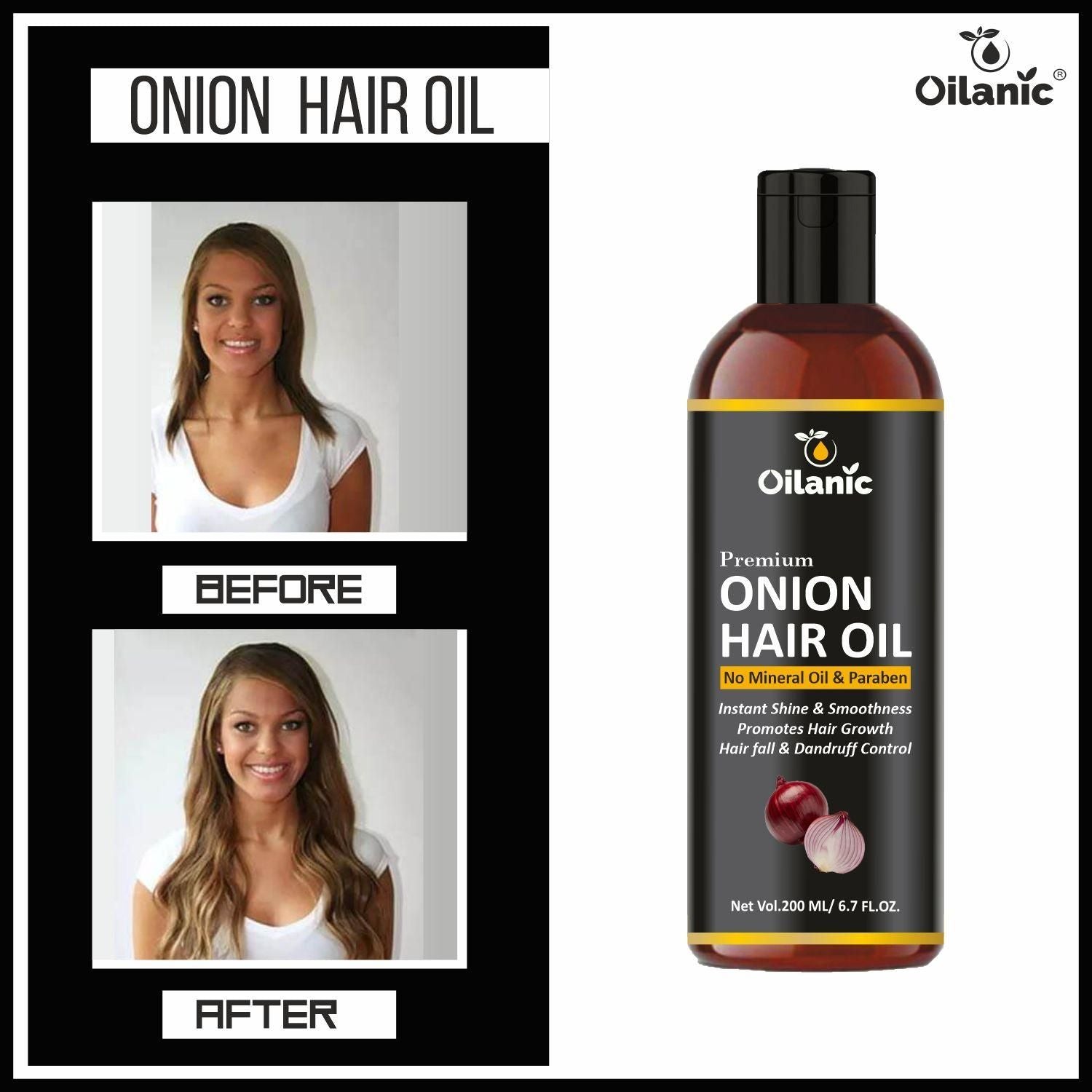 Oilanic Premium Onion Oil - For Healthy and Faster Hair Growth 200ml - Deal IND.