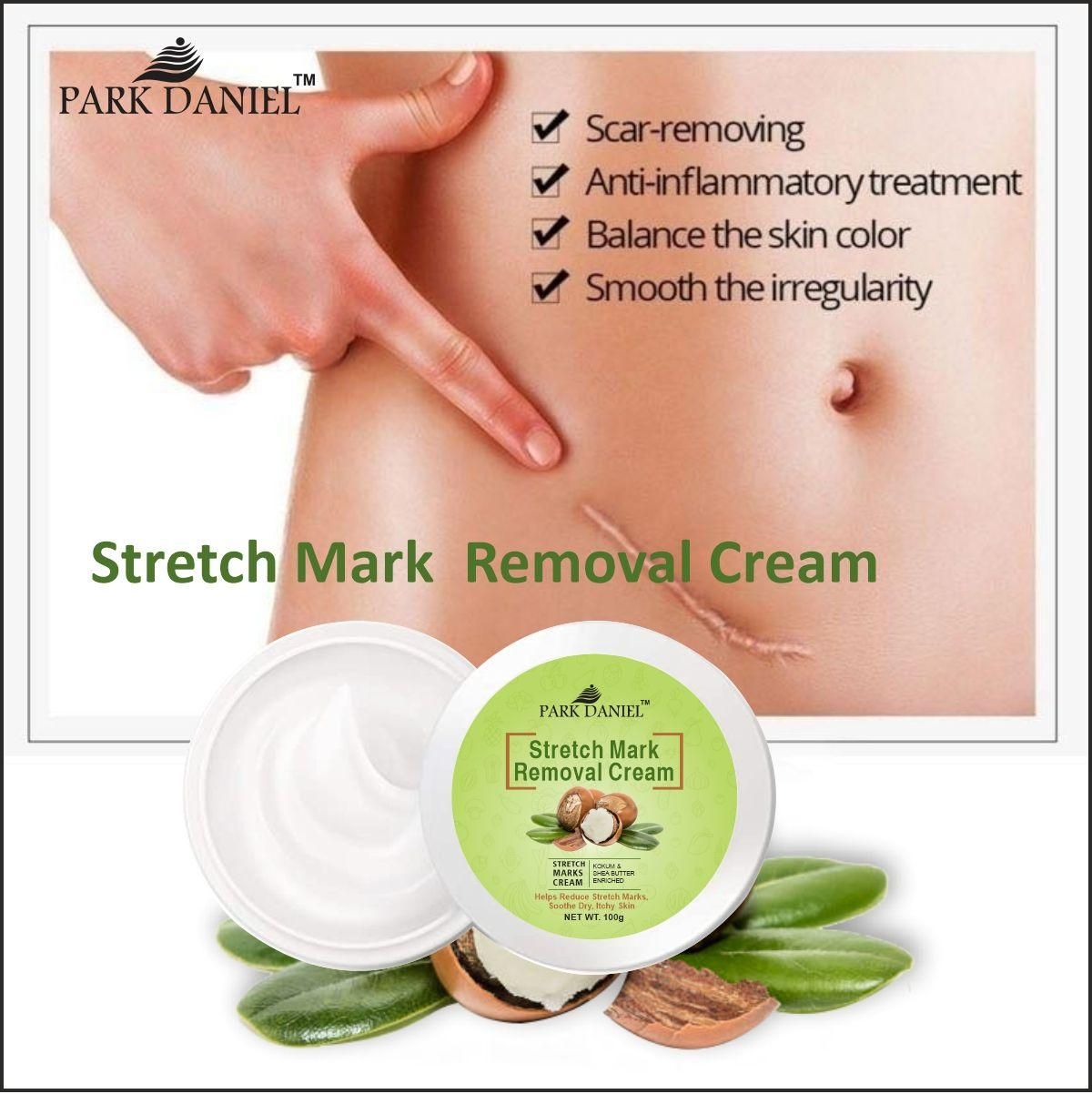 Park Daniel Stretch Marks Removal During Pregancy | Weight Loss Skin Toining (100 grams) - Deal IND.