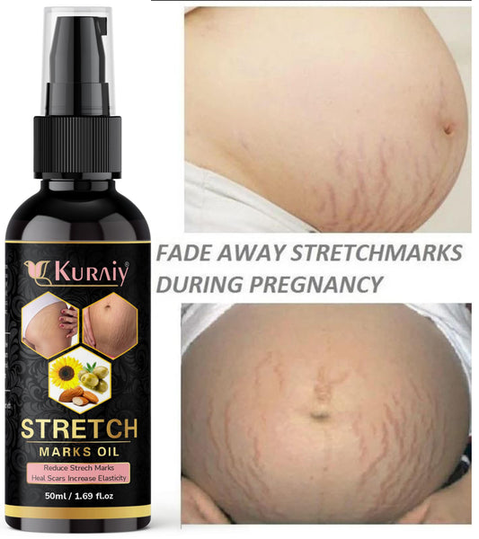 Kuraiy present Repair Stretch Marks Removal - Natural Heal Pregnancy Breast, Hip, Legs, Mark oil 500 ml pack of 1 - Deal IND.