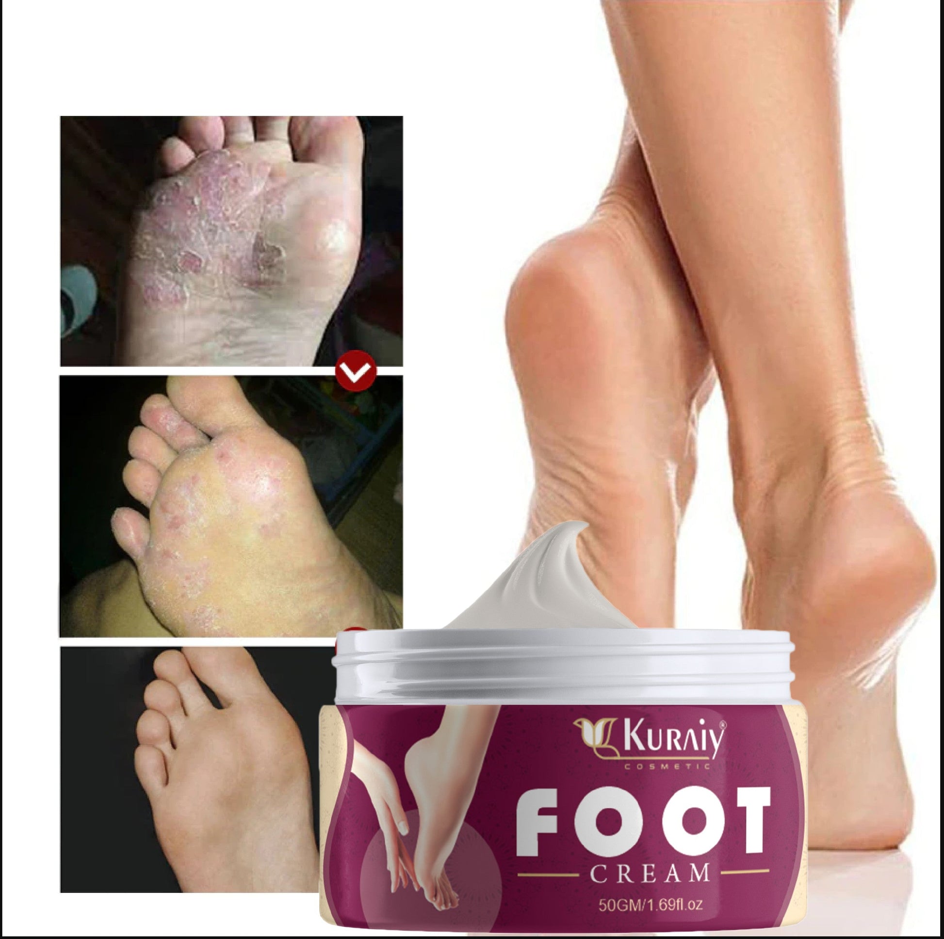 KURAIY Foot Crack Tea Tree Balm For Dry Cracked Heels & Feet Foot Cream & Hand Cream (50gm) ( For women and men) Pack of 1 Foot Creams & Lotions - Deal IND.