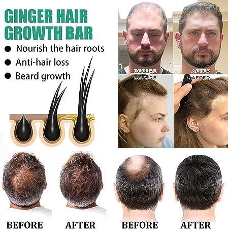 Ginger Hair Growth Bar (Pack of 1) - Deal IND.