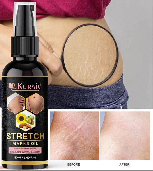 Kuraiy stretch Oil for Stretch Marks Removal Post Pregnancy fast work  result stretch mark cream oil  (50 ml) - Deal IND.