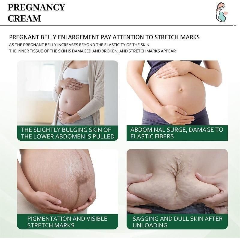 KURAI Pregnancy Scars, Acne Remove Cream - Deal IND.