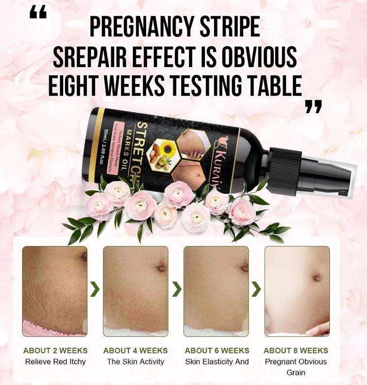 Kuraiy present Repair Stretch Marks Removal - Natural Heal Pregnancy Breast, Hip, Legs, Mark oil 500 ml pack of 1 - Deal IND.