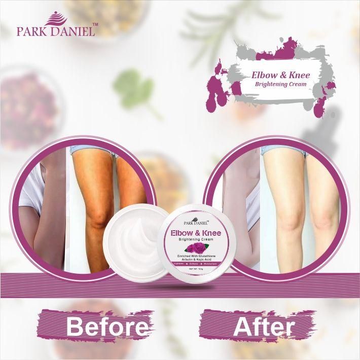 Park Daniel Elbow and Knee Whitening Cream - Dark Spot Removal Nourished Skin Pack of 2 (100 grams) - Deal IND.