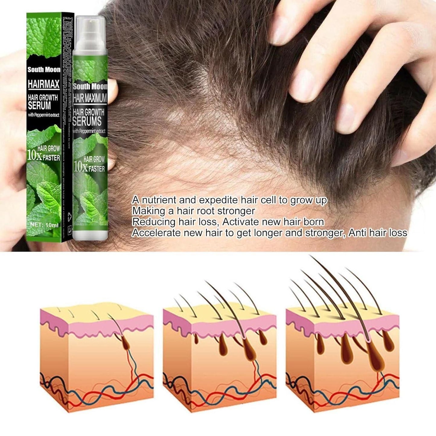 Ginger Plant Extract Anti-Hair Loss Hair Serum