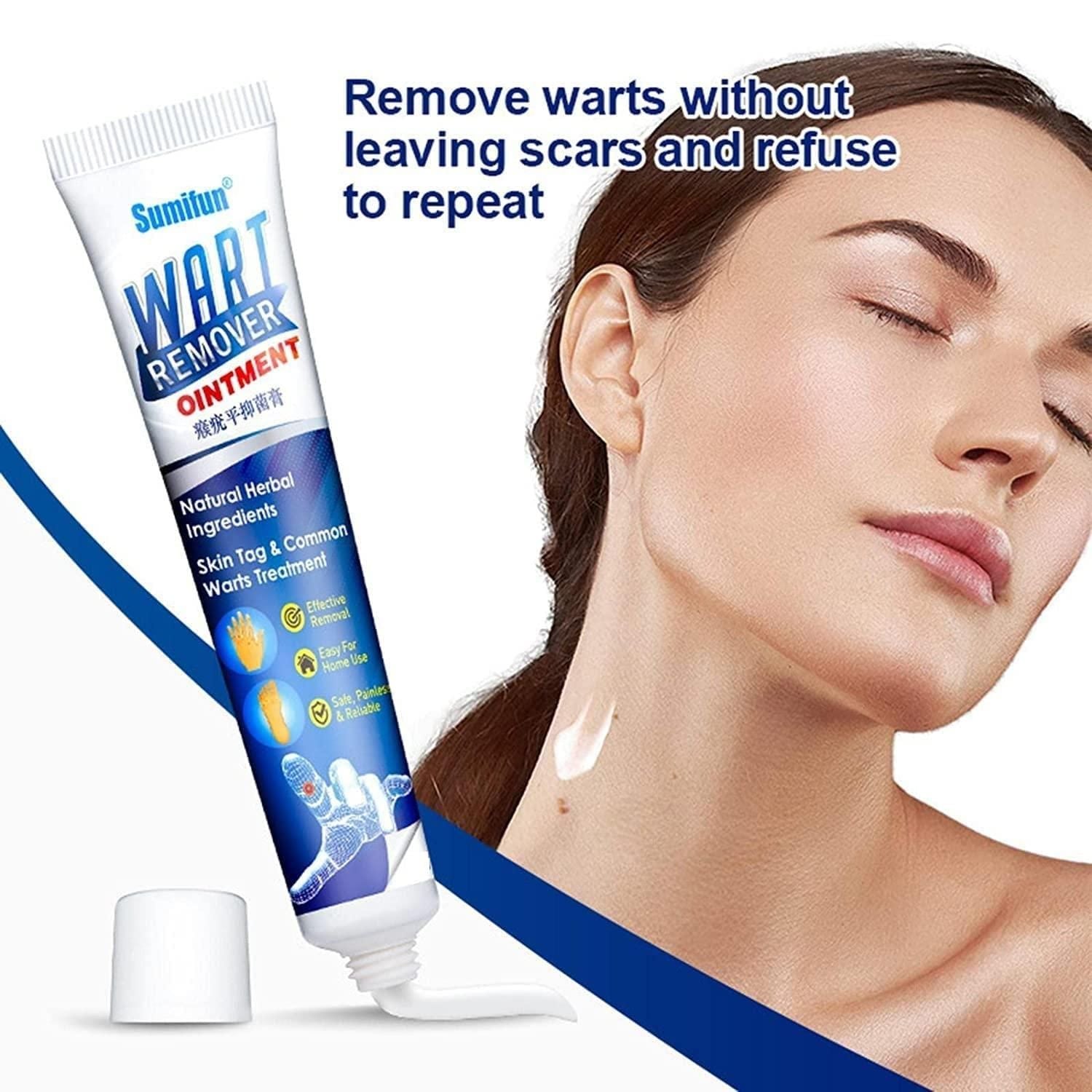 Warts Remover Cream Extract Skin - Deal IND.