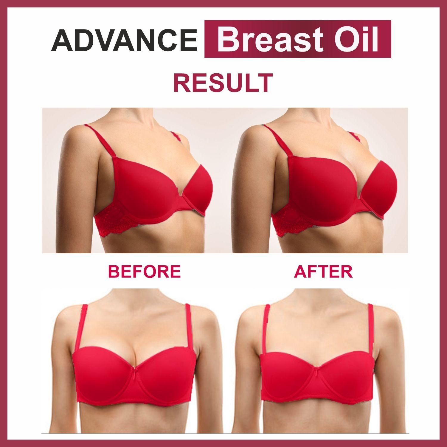 Oilanic Natural B 36 Plus Breast Enlargement Oil- For Firming, Lifting Up, Tightening, Reshaping & Breast Massage Combo Pack of 2 Bottles of 30 ml (60 ml) - Deal IND.