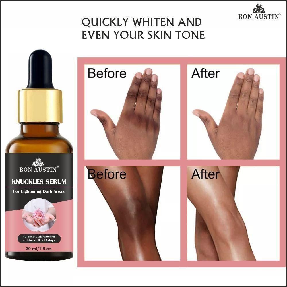 Bon Austin Skin Whitening Serum - Deal IND.