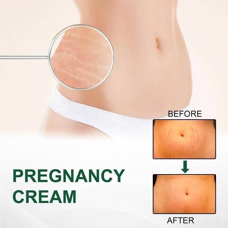 KURAI Pregnancy Scars, Acne Remove Cream - Deal IND.